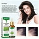 thumbnail image 4 of IBeaLee Herbal Hair Growth essence Hair Oil Hair Growth Agent Hair Nutrition Liquid, 4 of 5