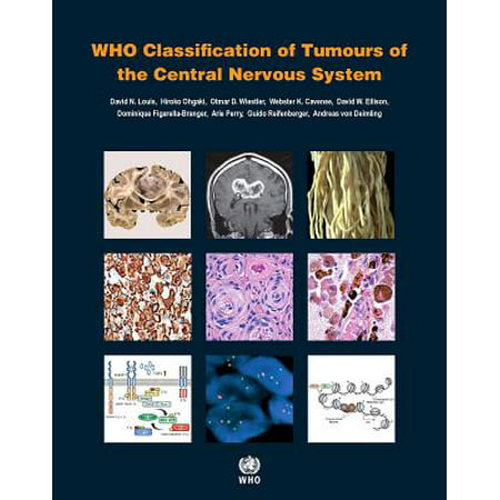 WHO Classification of Tumours of the Central Nervous