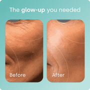 Biosil Collagen Generator - 120 Original Capsules