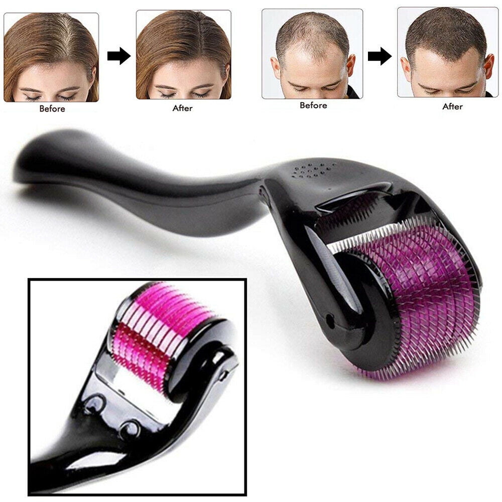 Cosprof 540 Micro-needling Derma Roller Hair Beard Regrowth Anti Hair Loss  Treatment - Walmart.com