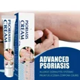 thumbnail image 2 of Pomada antimicrobiana para Psoriasis, tratamiento de Dermatitis, Eczema, antipicazón, alivia erupciones, Urticaria, descamación, Care9127, 2 of 5