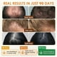 thumbnail image 3 of Pure Natural Hair Growth Oil Blend with Rosemary & Castor for Thicker Stronger Hair, 3 of 5
