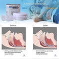 thumbnail image 5 of ANTI SNORING MOUTH GUARD, Device Sleep Aide Adjustable Mouth-Free Buds,Xmas Gift, 5 of 5