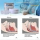 thumbnail image 5 of ANTI SNORING MOUTH GUARD, Device Sleep Aide Adjustable Mouth-Free Buds,Xmas Gift, 5 of 5