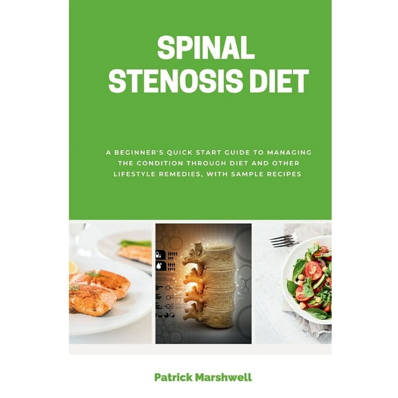 Spinal Stenosis Diet: A Beginner's Quick Start Guide to Managing the Condition Through Diet and Other Lifestyle Remedies, (Paperback)