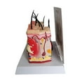 thumbnail image 5 of Skin Acne Model, Physiology Education, Doctor Anatomy Model, 5 of 5