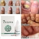 thumbnail image 2 of 10ml antihongos para el cuidado de los pies eliminación de hongos infección máxima fuerza tratamiento de uñas para reparación de hongos en los pies a base de hierbas ANGGREK Otros, 2 of 5