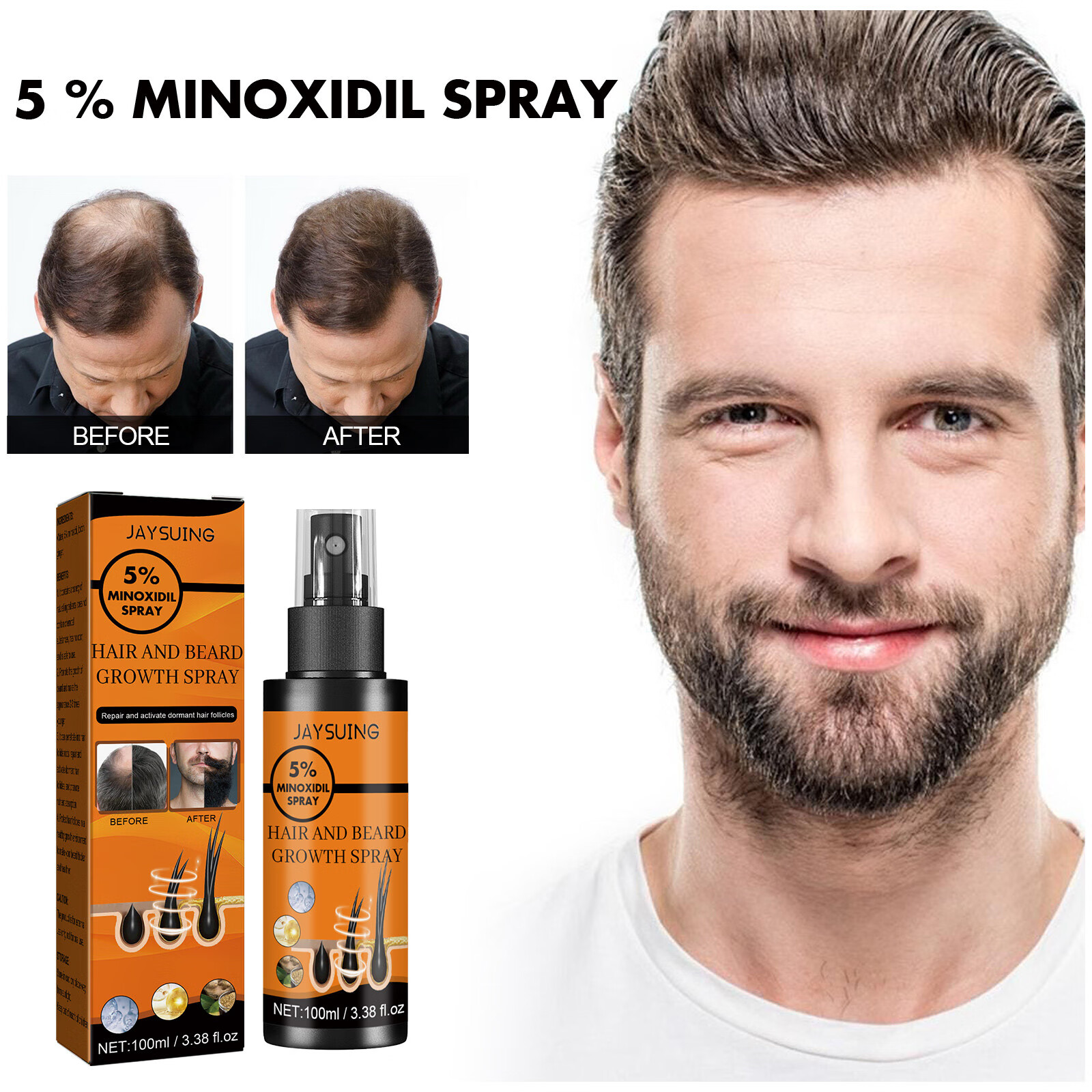 KAFEUPS 100ml 5 Minoxidil Hair Spray for Men and Women 100ml Hair