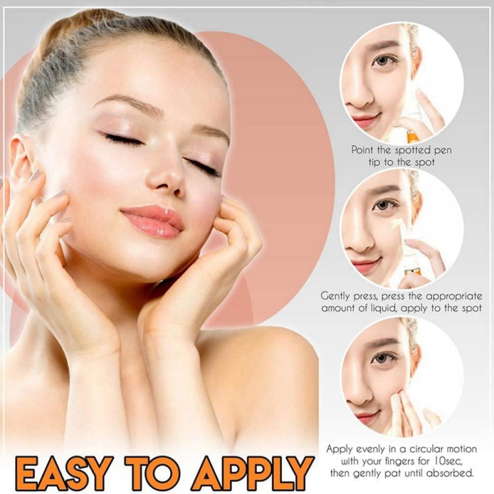 Buy Freckle Remover Cream, for Face Melasma Treatment Fade Cream with