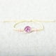 thumbnail image 1 of Nvzi Pulsera de flores hecha a mano - Pulsera de resina, pulsera ajustable, pulsera de flores - 2 piezas, rosa oscuro, 1 of 3
