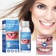 thumbnail image 2 of 1-3pcs Resin Tooth Repair Glue Shapeable Teeth Gaps Filling Solid Glue Temporary Teeth Repair Falseteeth Glue Safety Dental Supplies, 2 of 4