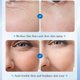 thumbnail image 5 of Intensive Repair Serum, 15%Hyaluronic Acid for Sensitive Skin Anti Aging Ultra Hydrating Serum for Face, 5 of 5