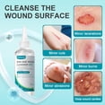 thumbnail image 3 of Dimora First Aid Antiseptic Cleanser, OTC Antimicrobial Wound Wash for Cuts, Scrapes & Burns - Skin-Neutral pH Skin Cleanser, 3-Pack Non-Irritating Travel Size Wound Care (6 oz Total), 3 of 11