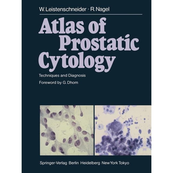 Atlas of Prostatic Cytology: Techniques and Diagnosis, (Paperback)