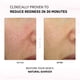 thumbnail image 2 of Crema facial Physiogel Calming Relief Enrojecimiento 30 ml, 2 of 7