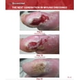 thumbnail image 3 of Kit de primeros auxilios en gel SilvrStat Silver Healing, apósito para heridas de 30 ml, 3 of 9