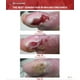 thumbnail image 3 of Kit de primeros auxilios en gel SilvrStat Silver Healing, apósito para heridas de 30 ml, 3 of 9