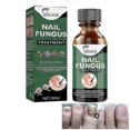 thumbnail image 1 of EELHOE Nail Repair Liquid Gray Nail Liquid Uneven Thick Nail Thickening Gray Nail Soft Nail Hand and Foot R, 1 of 4