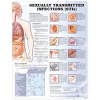 Sexually Transmitted Infections (STIs)