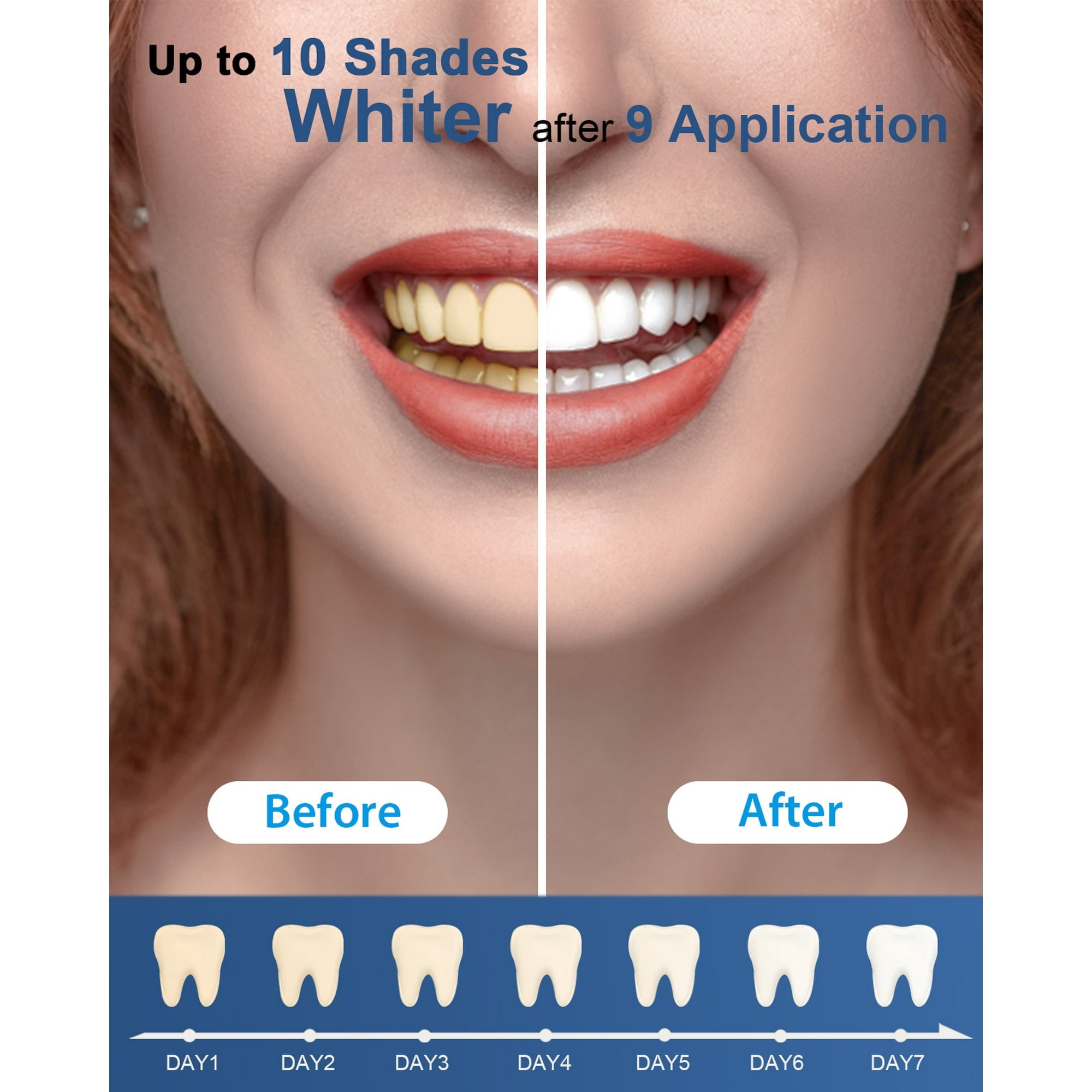 MySmile Teeth Whitening Kit with 5-LED Teeth Whitening Light Tray, Non-Sensitive Gentle 3*3ml Teeth Whitening Gel Refill, Tooth Whitener, Mint