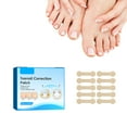 thumbnail image 1 of Pegatinas correctoras de uñas encarnadas, parche Corrector de uñas, herramienta de corrección de uñas, parche Corrector de uñas, herramientas de pedicura, 1 of 8