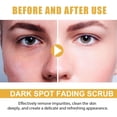 thumbnail image 4 of Yttmshdga Clearance! Personal Skin Care Scrub Set Scrub Face Wash Face Scrub Scrub For Dark For Dark Reduction Hyperpigmentation (1Set) 100ml, 4 of 9