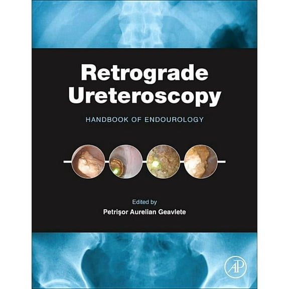Retrograde Ureteroscopy: Handbook of Endourology, (Hardcover)