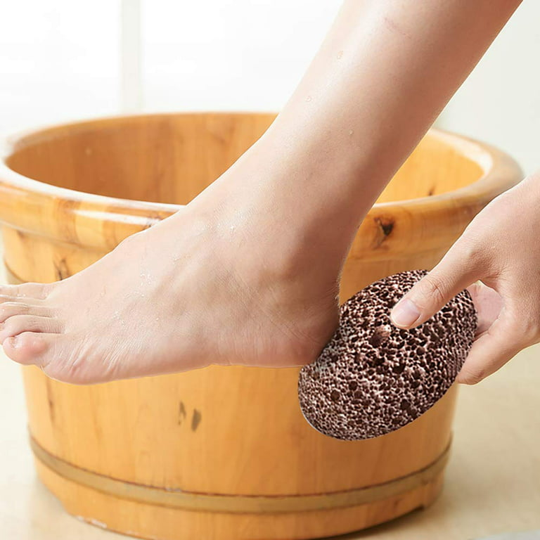 Portable Pumice Stone Foot File For Smooth And Soft Feet - Removes Hard Dead  Skin, Cracked Heels, And Calluses In Minutes - Perfect For At-home Foot  Care - Temu