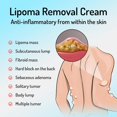 thumbnail image 4 of 3PCS Fat Knot Cream Relieves Fat Clumps Subcutaneous Lumps Body Care Cream, Relieves Fatty Lumps Tumors Subcutaneous, 4 of 5