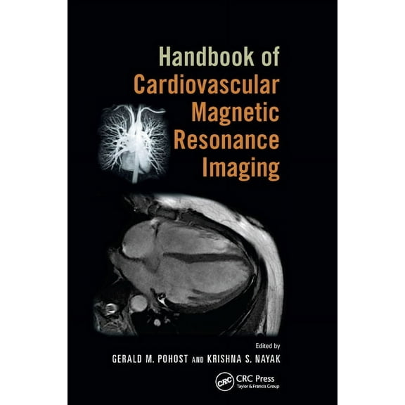 Fundamental and Clinical Cardiology Handbook of Cardiovascular Magnetic Resonance Imaging, Book 60, (Paperback)