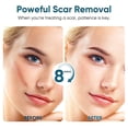 thumbnail image 4 of Fade Scar Gel, Surgical Skin Repair Cream, Advanced Scar Therapy For Surgery, C-section, Keloid, Injury, Burns, Scars Smoothing, 4 of 5