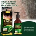 thumbnail image 2 of Champú antipicazón Hair Moss, limpieza del cuero cabelludo, anticaspa, control de grasa capilar, antipicazón, refrescante y reparador, 100 ml, 2 of 4