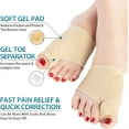 thumbnail image 2 of Bunion Corrector for Women and Men, NOGIS Big Toe Straightener with Splint & Pads, Comfortable & Breathable for Day/Night Support, Hallux Valgus Pain Relief Non-Slip Socks (Beige), 2 of 7