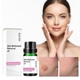 thumbnail image 2 of Barsme Birthmark Removal Oil,Help Lighten Birthmarks And Pigmentation.10Ml 3Pc, 2 of 9