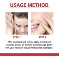 thumbnail image 5 of 30ml Dark Spot Correcting Serum 10% Niacinamide + 4%Tranexamic Acid for Post Acne Marks, 5 of 5