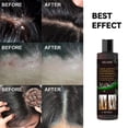 thumbnail image 5 of 2pcs Tinea Capitis Anti-Itch Shampoo Anti-Drop Refreshing Oil Control Hair Care Anti-Dandruff Anti-Itch Shampoo, 5 of 5