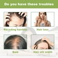 thumbnail image 5 of 2PCS Organics Rosemary Mint Scalp & Hair Strengthening Oil With Biotin & Essential Oils, Nourishing Treatment for Split Ends and Dry Scalp for All Hair Types, 2-Fluid Ounces, 5 of 8