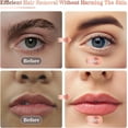thumbnail image 4 of Hoeylife Facial Hair Remover for Women - Painless Face Shaver - Electric Hair Removal Device for Face Lips Peach Fuzz with Light (Whtie), 4 of 8