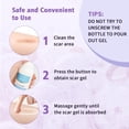 thumbnail image 4 of Silicone Scar Gel For Face Body Smooths Scar Texture Gentle Skin Care 1.7oz, 4 of 7