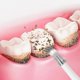 thumbnail image 3 of Electric toothbrush tartar remover set 7-piece Black, 3 of 4