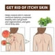 thumbnail image 3 of 2025 Psoriasis Dandruff Treatment for Scalp, Anti Itching Follicle Booster Stimulator Smoothing Nourishing Hair SerumZZ16, 3 of 5