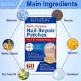 thumbnail image 4 of Nail Correction Stickers Ingrown Toenail Corrector Patches Treatment Recover Co, 4 of 5