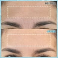 thumbnail image 2 of Yecuce 3-Pack Forehead Wrinkle Patches with Aloe, Collagen, Vitamin E, Anti Wrinkle ,Nourishes for Radiant Skin, 2 of 9
