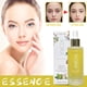 thumbnail image 2 of Essence Oils For Candles Essential oils Facial Skin Barrier Relief Sensitive Skin Rejuvenation Firming Moisturizing 30ML Oil(buy 2 get 10% off), 2 of 5