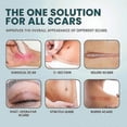 thumbnail image 5 of Láminas de silicona para cicatrices, cinta de silicona para eliminar queloides (rollo de 2 x 100 cm) - Cinta para cicatrices quirúrgicas, cesárea, abdominoplastia, quemaduras y acné., 5 of 5