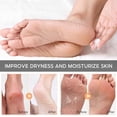 thumbnail image 6 of Banzch Urea Cream 40% | 2% Salicylicacid | Intensive Urea Foot Cream & Callus Remover | With Aloevera And Teatree Oil For Deep Moisturing And Skin Softening 30ml,Mothers Day Gifts, 6 of 7