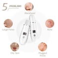thumbnail image 3 of Espátula exfoliante facial Liedrg, eliminador de puntos negros, 4 en 1, 3 of 7