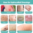 thumbnail image 3 of QARUN 2026 New 2In*16Ft Hydrocolloid Roll for Wound Care, Hydrocolloid Patch Large Bandages with Self-Adhesive, Ultra Absorbent, Flexible, Waterproof, Diy Size, First Aid Kit Essential, 3 of 7