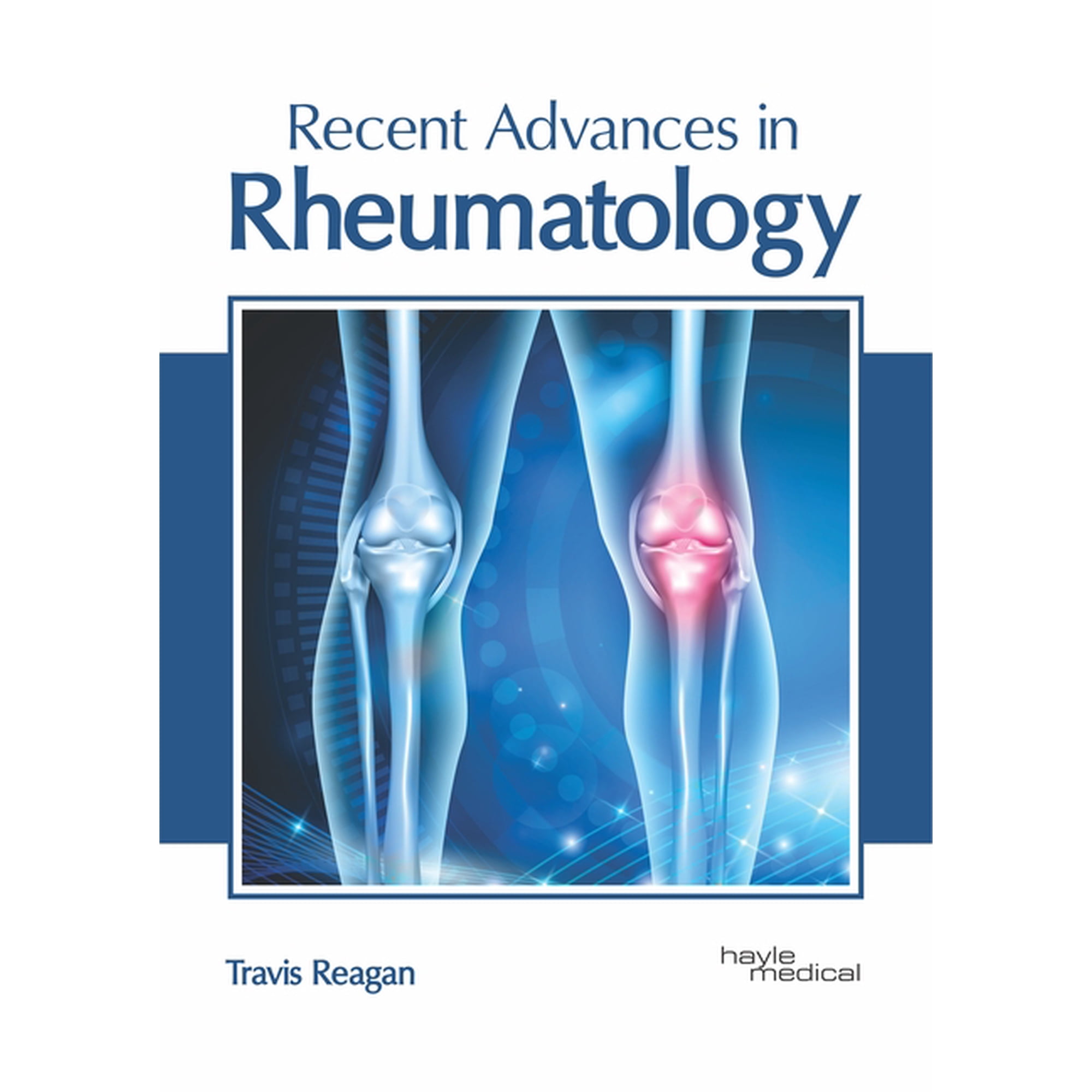 Recent Advances in Rheumatology, (Hardcover)