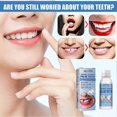 thumbnail image 5 of Moldable Dental-Gums Instants Smile Makeovers for Men Women, 5 of 5